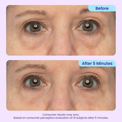 Lumessea InstantLift™ Eye Gel™