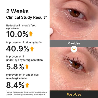 Lumessea Golden Glow Eye Patches