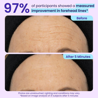 Lumessea InstantLift™ Eye Gel™