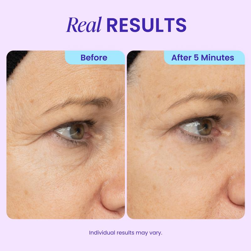 Lumessea InstantLift™ Eye Gel™